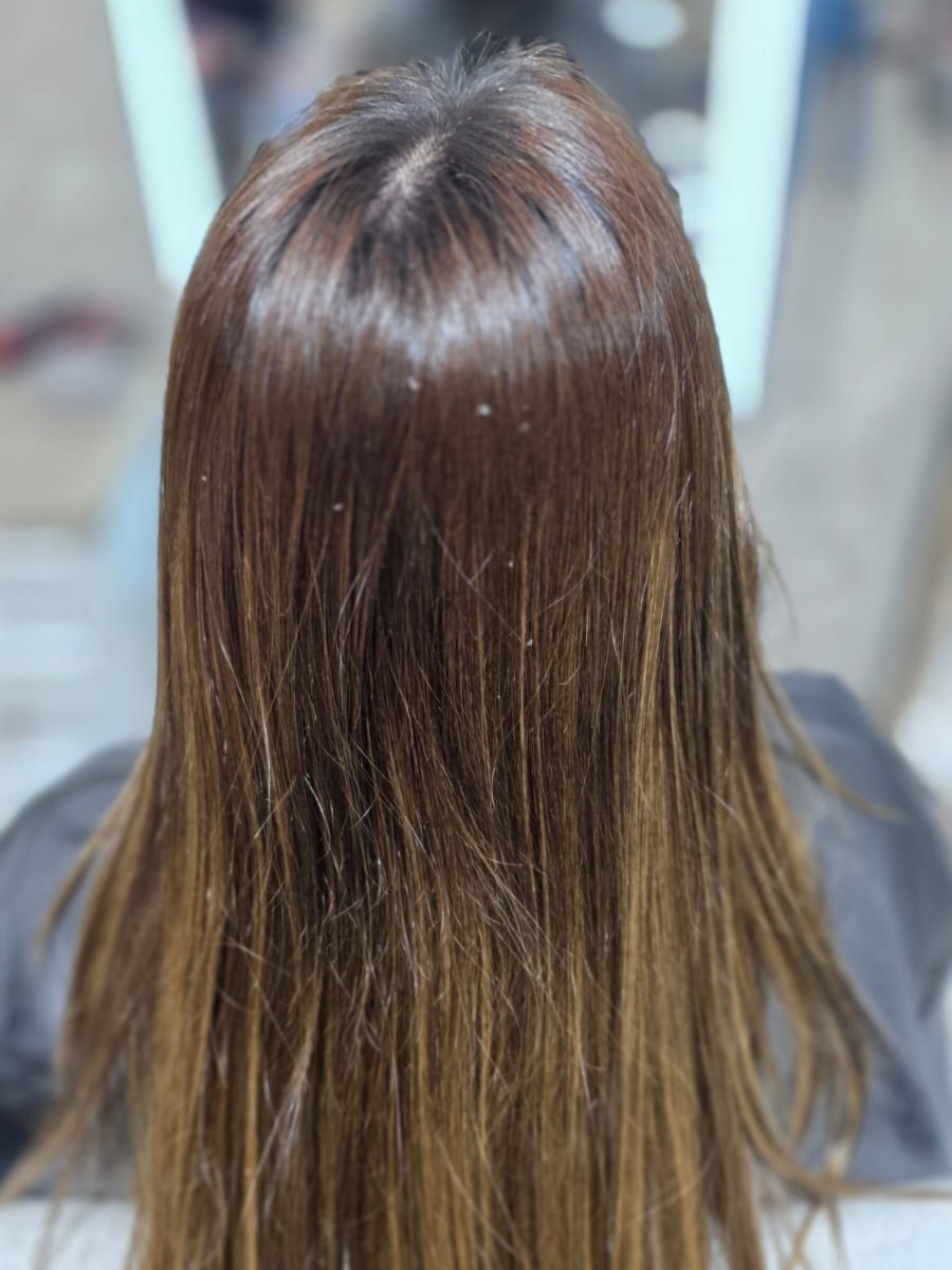 Antes